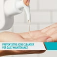 CeraVe Acne Control Facial Cleanser for Oily Skin, 8 oz