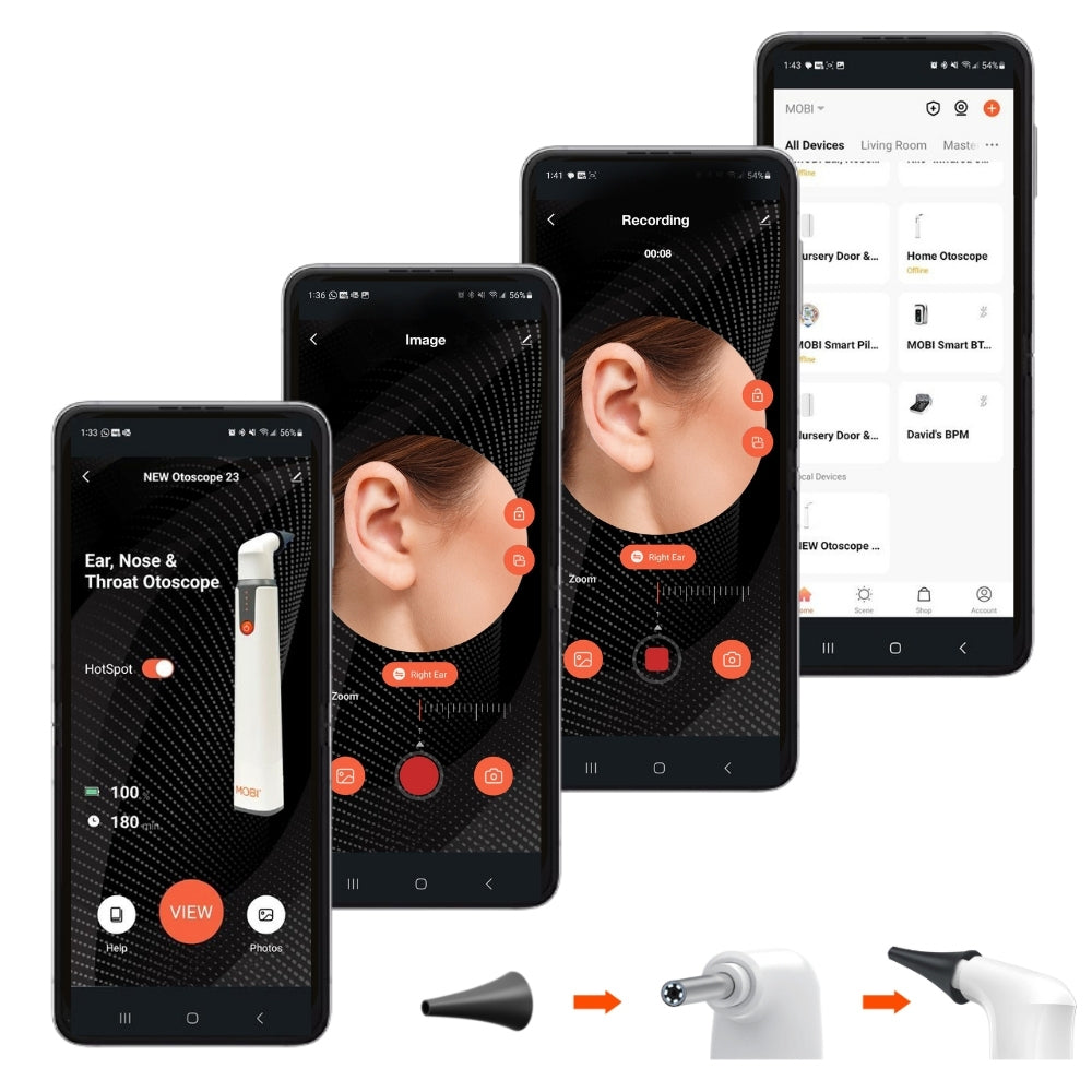 MOBI OTOSCOPE EAR NOSE & THROAT ENT