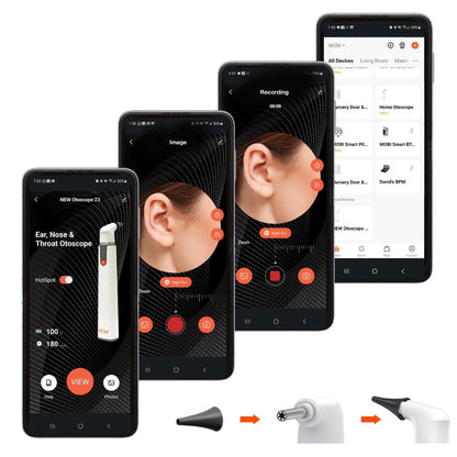 MOBI OTOSCOPE EAR NOSE & THROAT ENT
