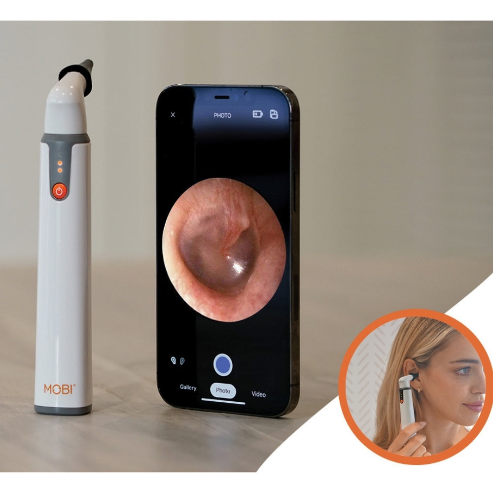 MOBI OTOSCOPE EAR NOSE & THROAT ENT