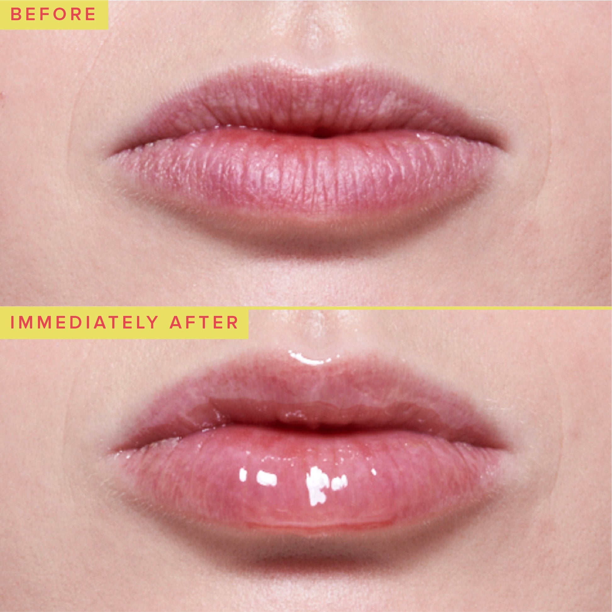 LIP TRMT PEPTIDE BERRRY