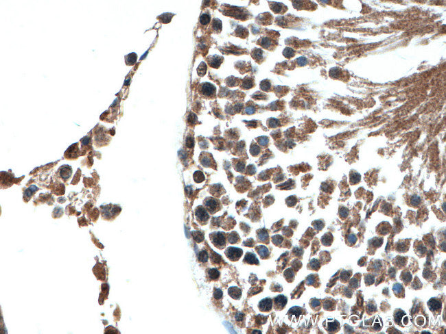 IMMUNE,OG2,THERAPY,CIT