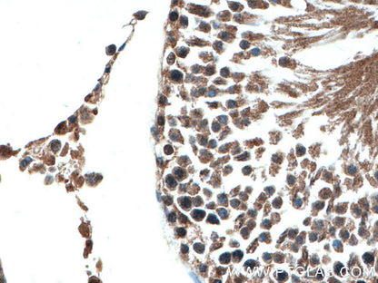 IMMUNE,OG2,THERAPY,CIT