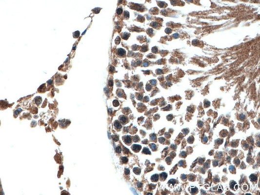 IMMUNE,OG2,THERAPY,CIT