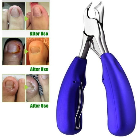 TOENAIL CLIPPER