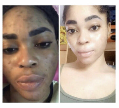 55 H+ SERUM EXTREME       50ml