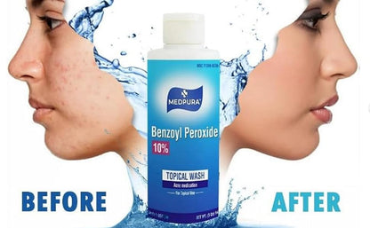 MEDPURA ACNE TRM GL 10% 90GM
