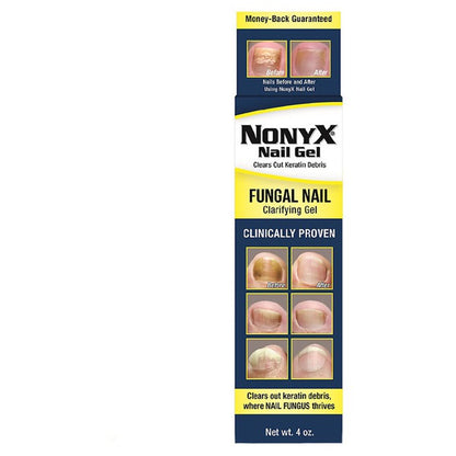 NONYX NAIL GEL 4OZ