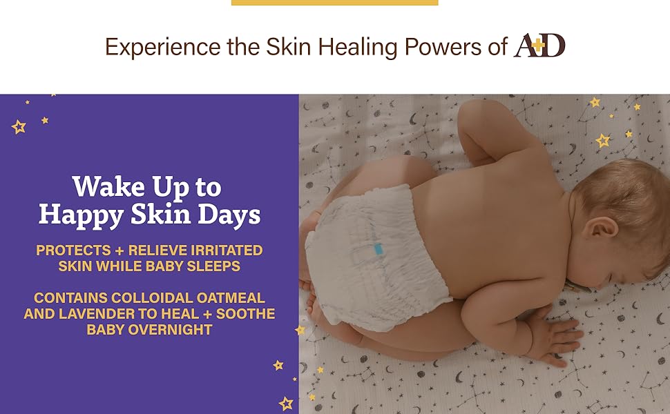 A+D OVERNIGHT HEALING RASH ONT 3.6OZ