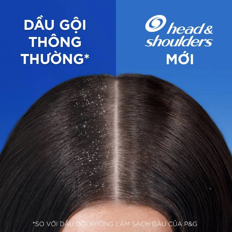 HEAD/SHLDR LQ 6.7OZ APL/CDR/VN