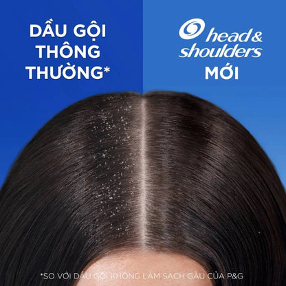 HEAD/SHLDR LQ 6.7OZ APL/CDR/VN