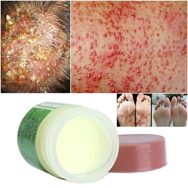 SP,ECZMA&PSORIASS309056-0
