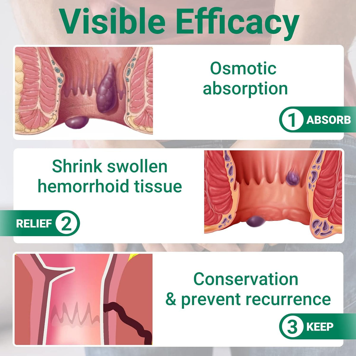 LDR HEMORRHOIDAL OI 57GM W/APL