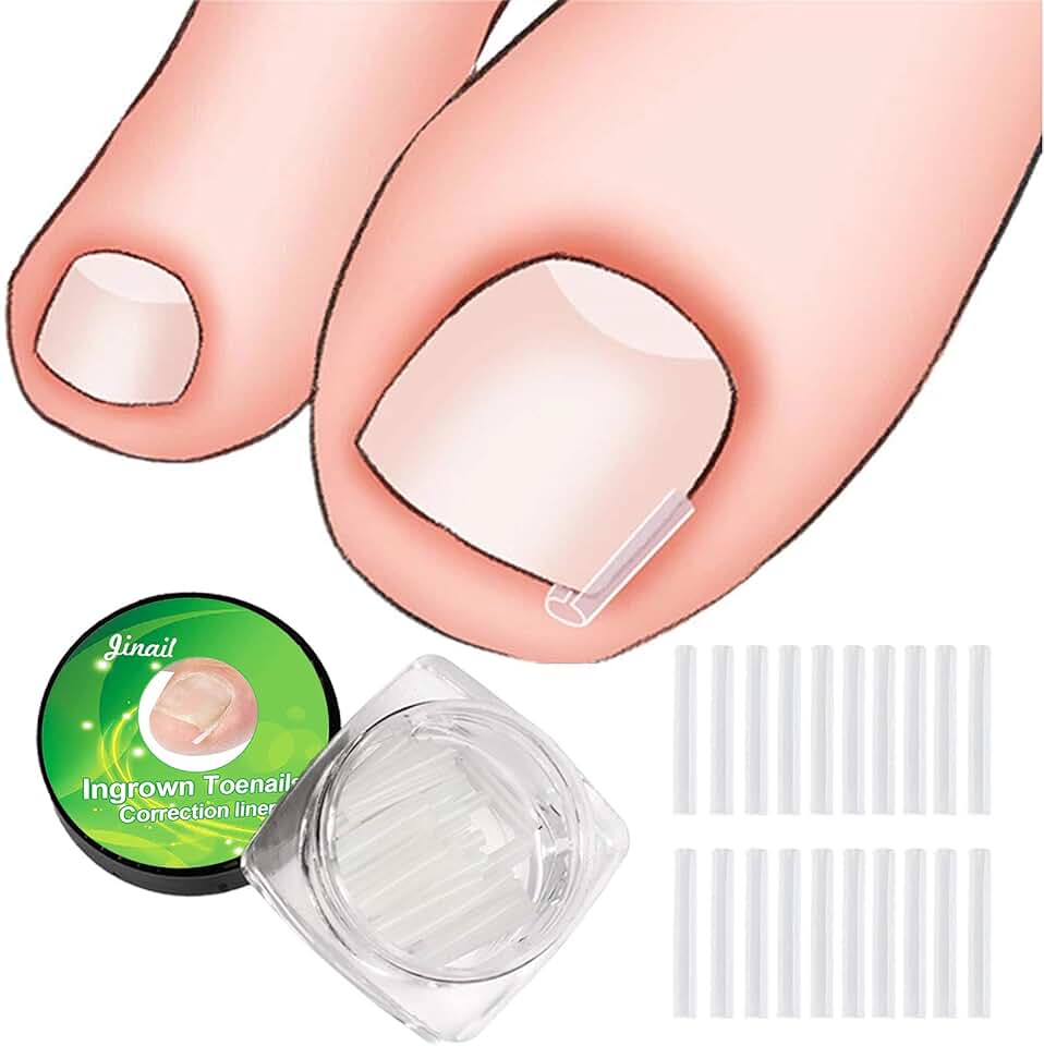 TopCare Toenail Clip Straight Cut