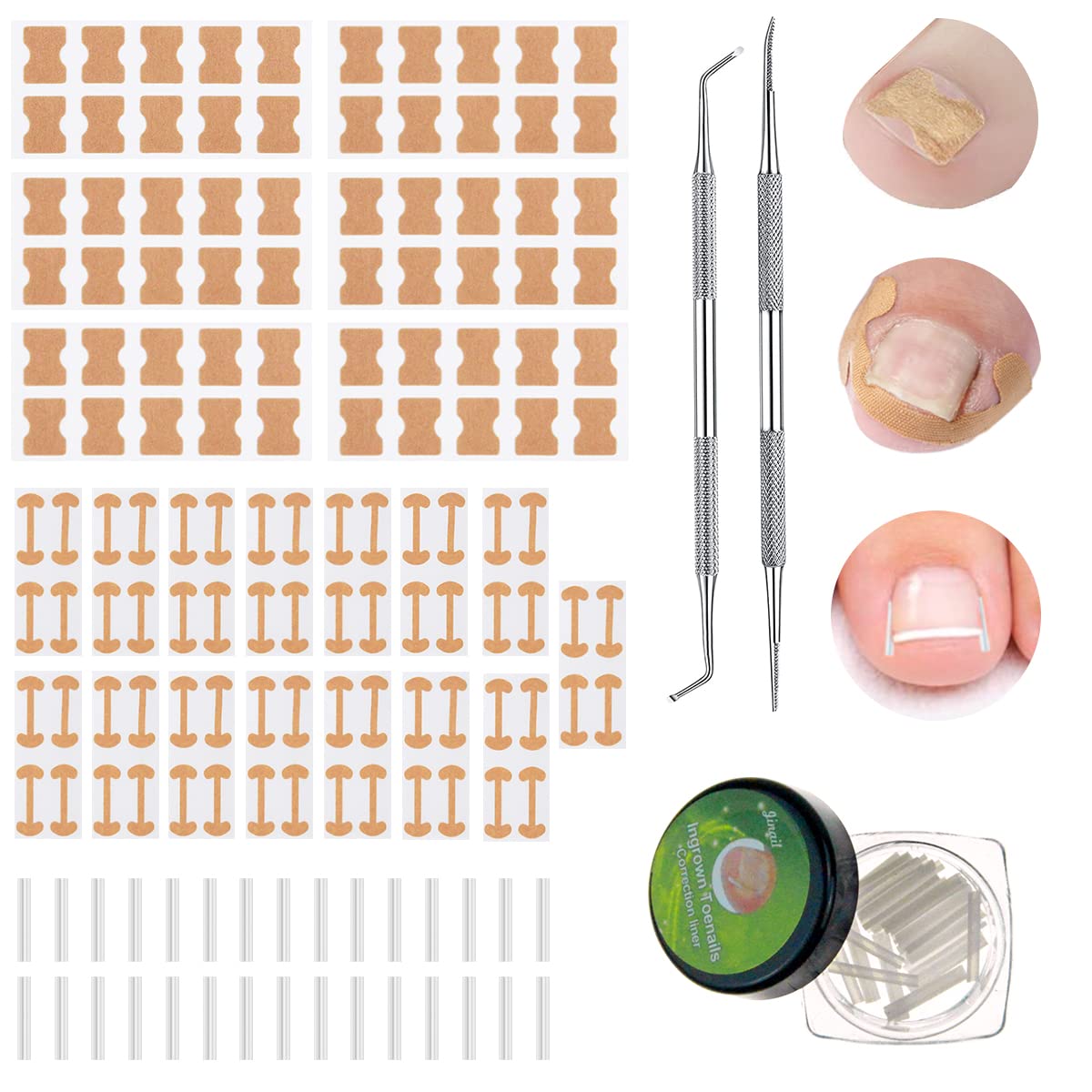 Topcare Toenail Clip With File