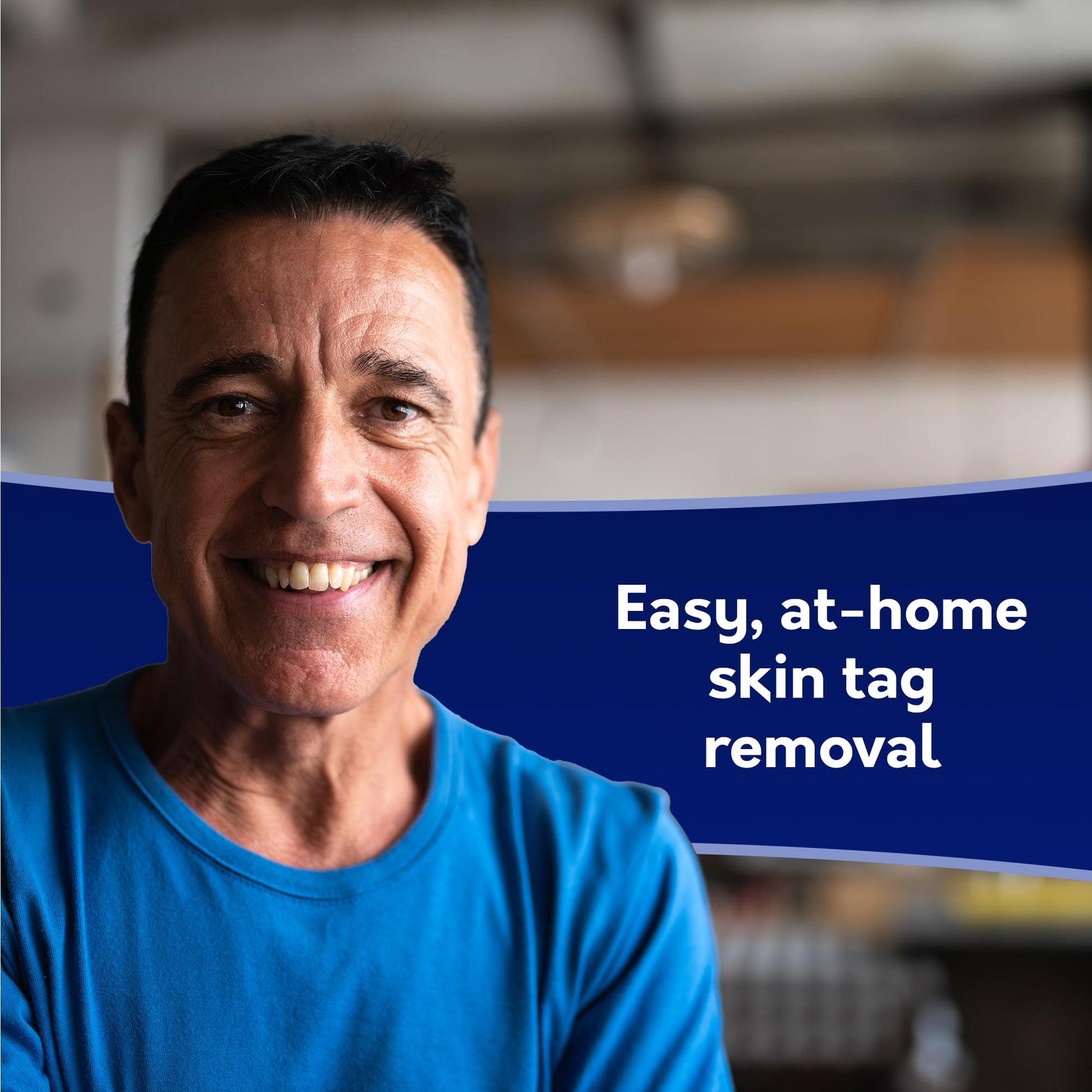 COMPOUND W FREEZE OFF SKIN TAG RM