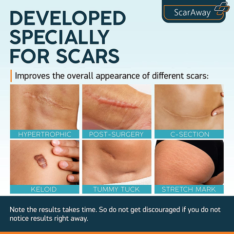 SCARAWAY GL 20GM ADV FRML