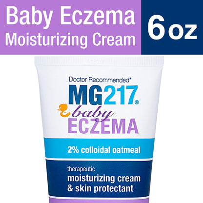MG217 BABY ECZEMA CR 2% 170GM