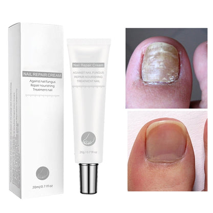 NAIL FUNGUS CONTROL,OG2