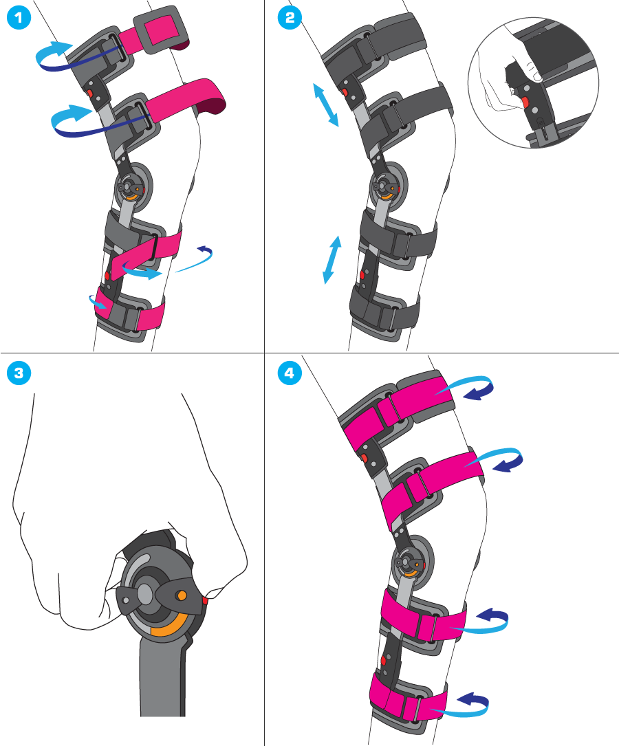 NEO G HINGED OPEN KNEE BRACE - OSFA