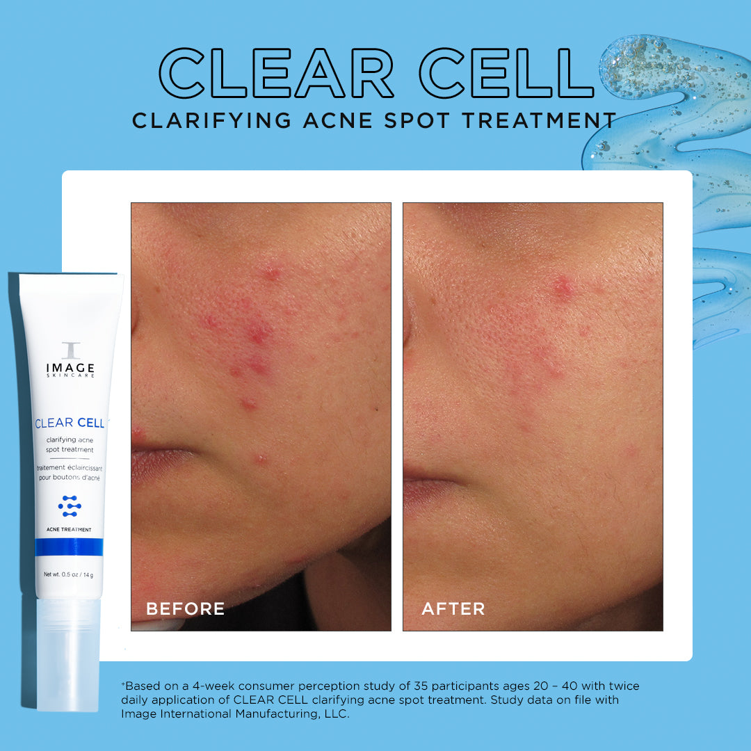 ACNE SPOT,INCREDBLY CLEAR