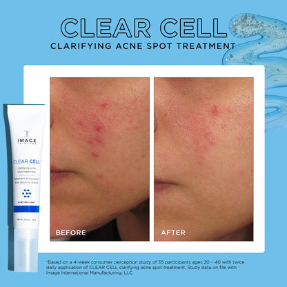 ACNE SPOT,INCREDBLY CLEAR