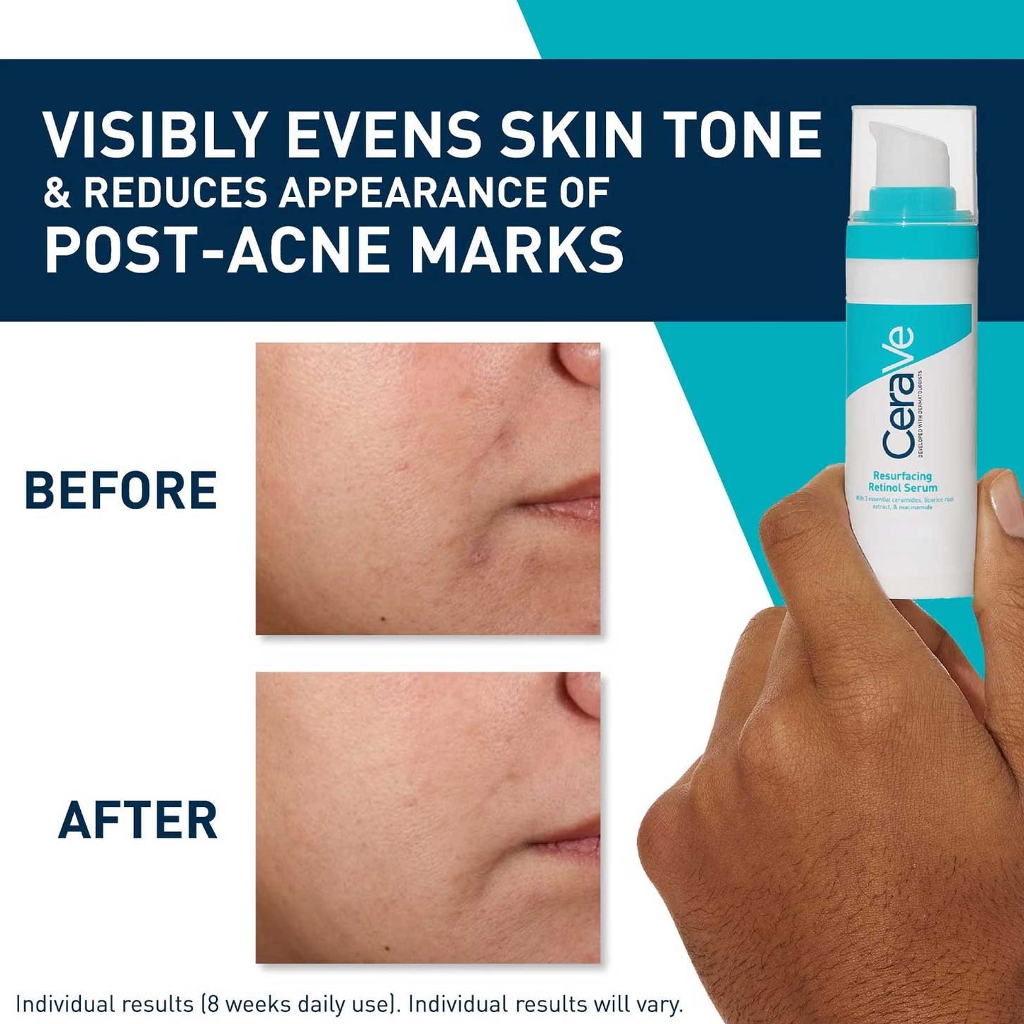 Cerave Resurfacing Retinol Serum 1oz