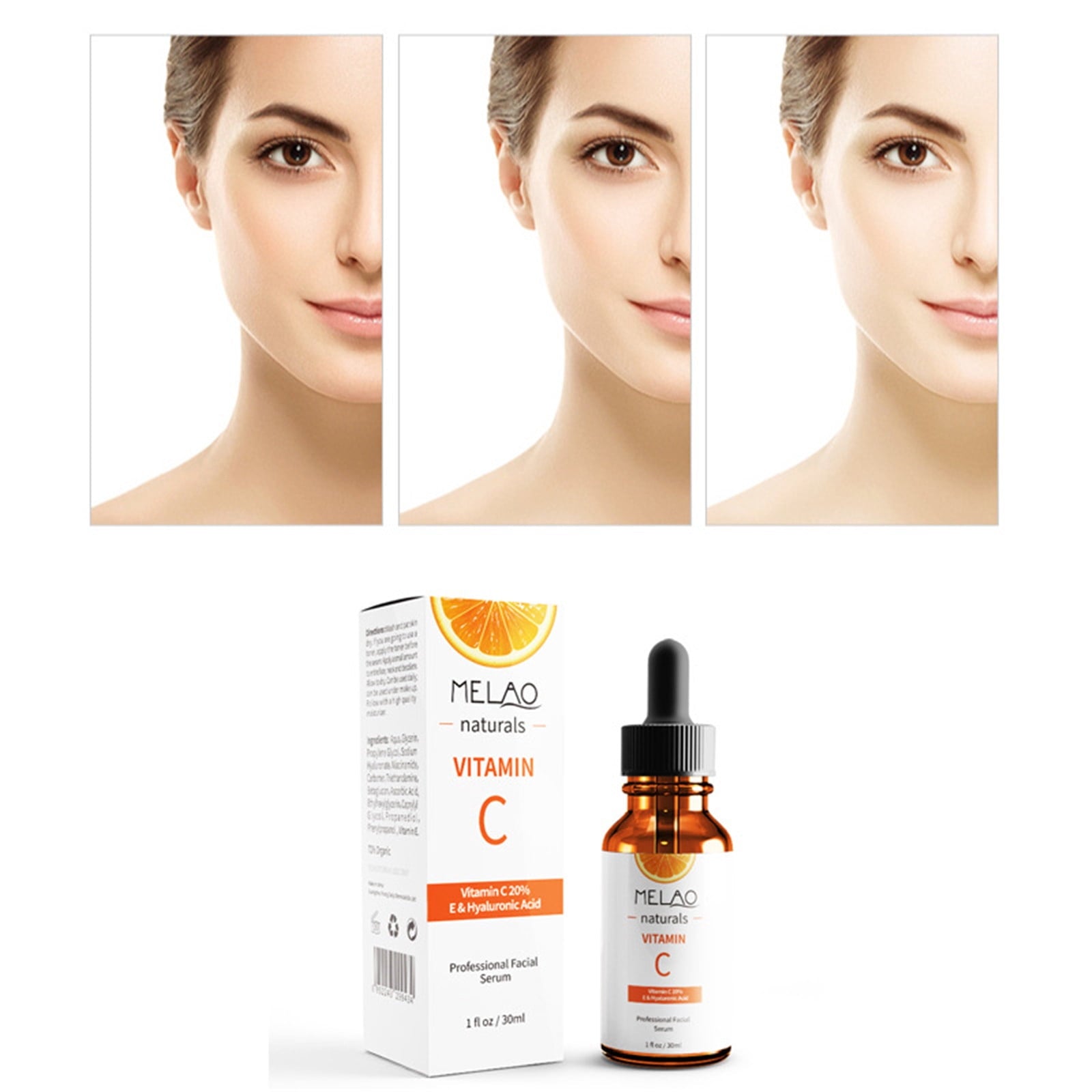 SERUM HYDR HYAL ACID & VIT C