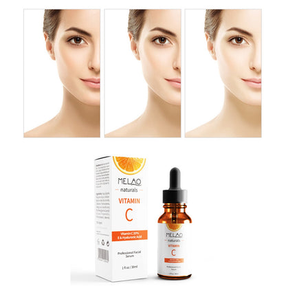 SERUM HYDR HYAL ACID & VIT C