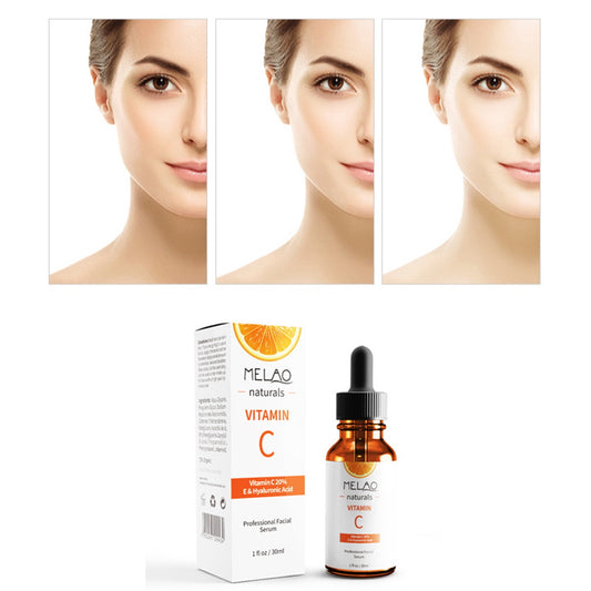 SERUM HYDR HYAL ACID & VIT C