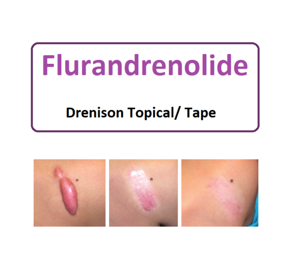 FLURANDRENOLIDE LT 0.05% 120ML