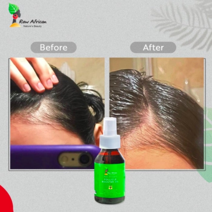 CANVAS FOLLICLE BOOSTER     8OZ