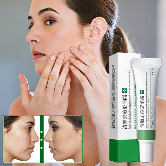 CLEAR ACNE FACE MSTRZ CR 2% 50ML