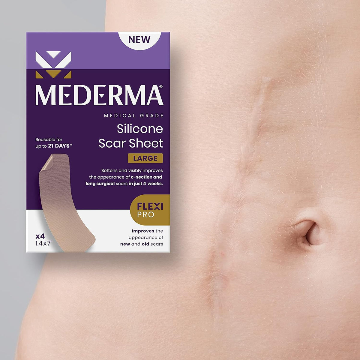 MEDERMA SCAR SHEET AP 4