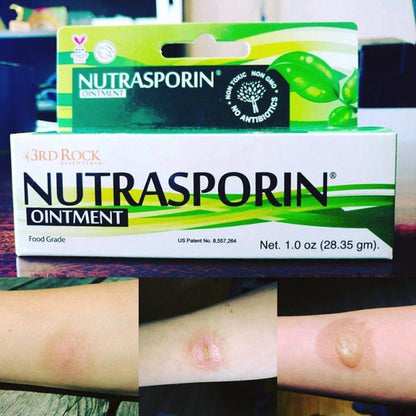 3RD ROCK ESSENTIALS OINTMENT,NUTRASPORIN