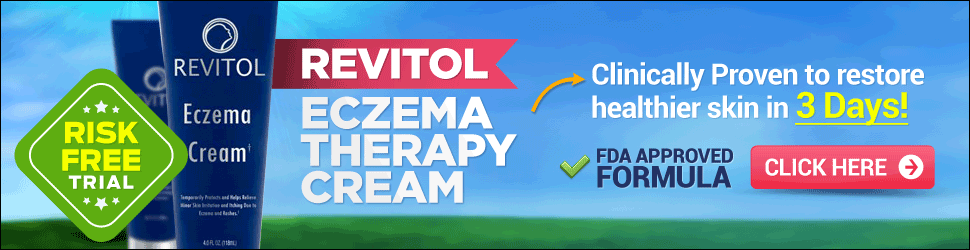 ECZEMA RELIEF CR 1% 150ML