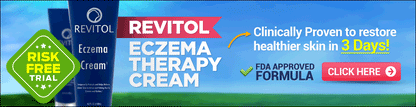 ECZEMA RELIEF CR 1% 150ML