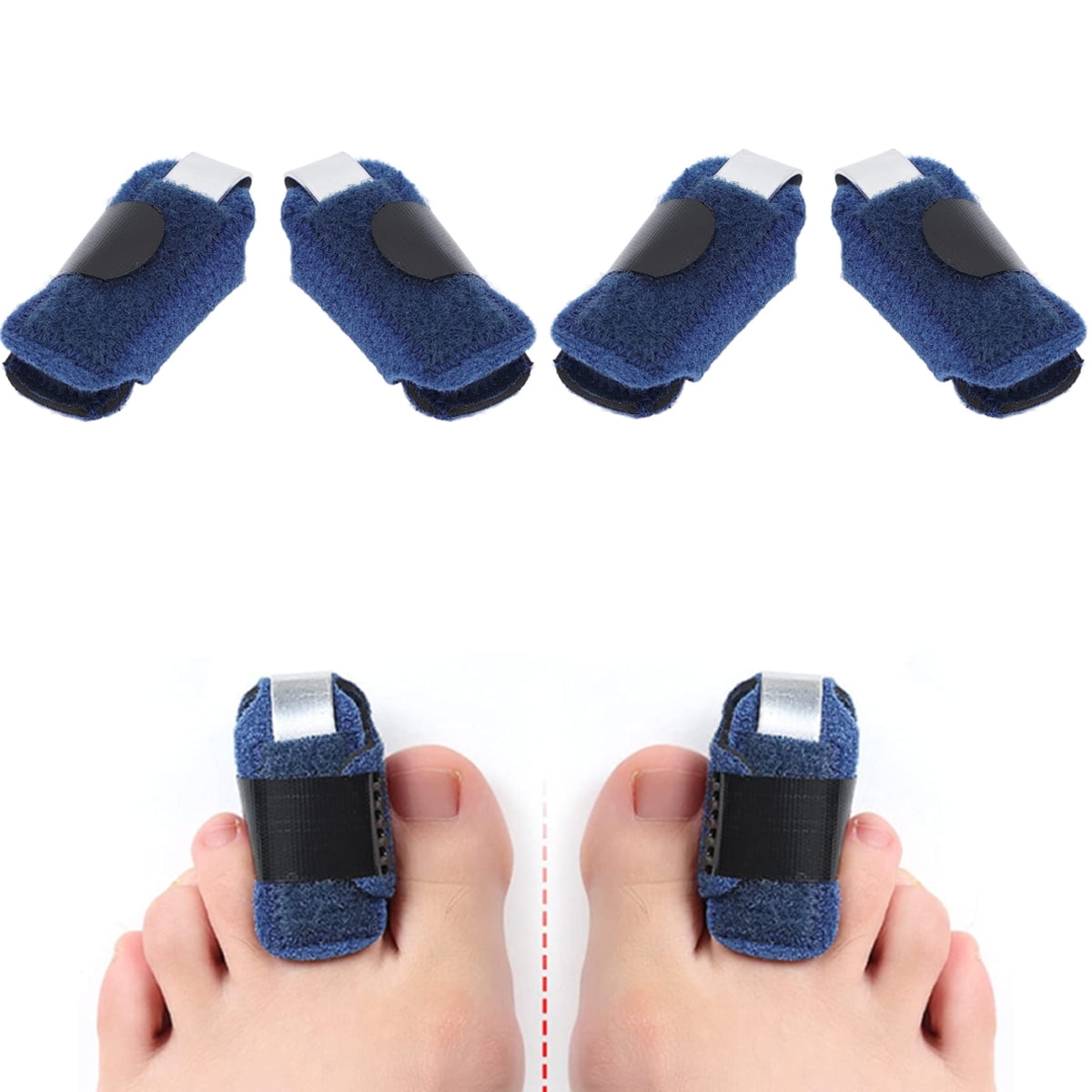 TOE STRAIGHTENER SB OSFM
