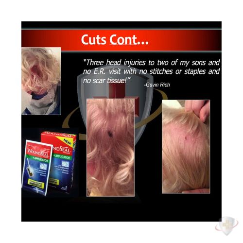 WOUNDSEAL W/APPLICATOR PWD 4CT