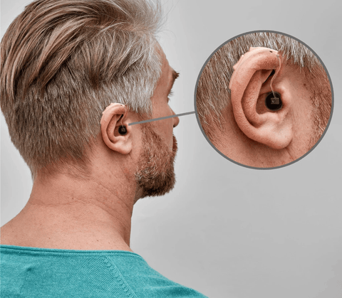 AUDIEN ION PRO RCH KT DSHP