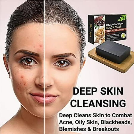 African Formula Black Soap 3.5oz Cocoa Butter & Vitamin-E