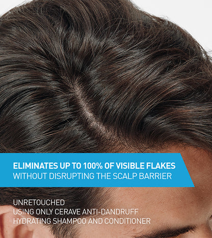 Cerave Shampoo Anti-Dandruff 2 In 1 Hydrating 12oz