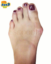 BUNION RGLTR SB MD L DSHP