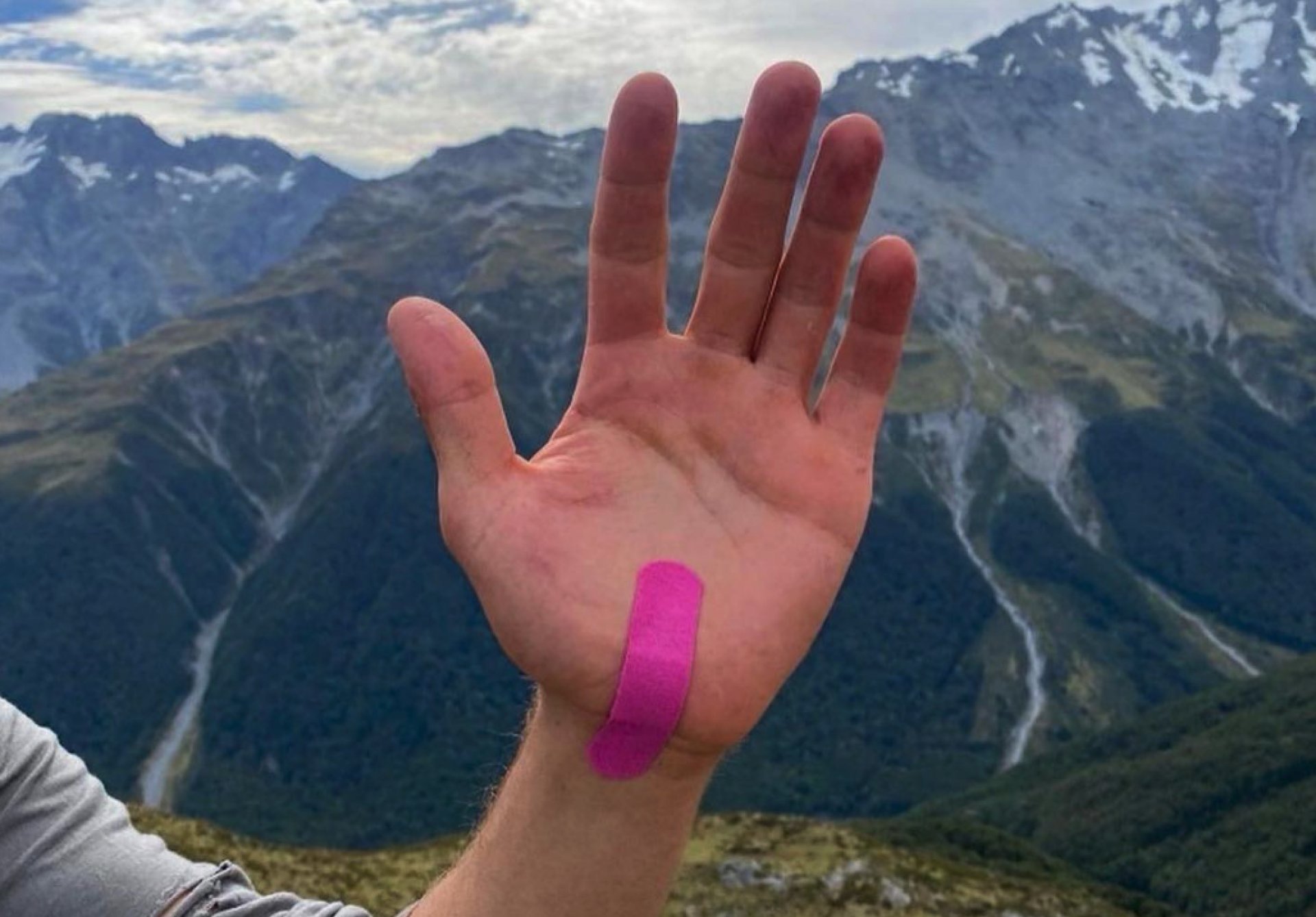 WOOLAID BANDAGES,OUTDOOR PACK